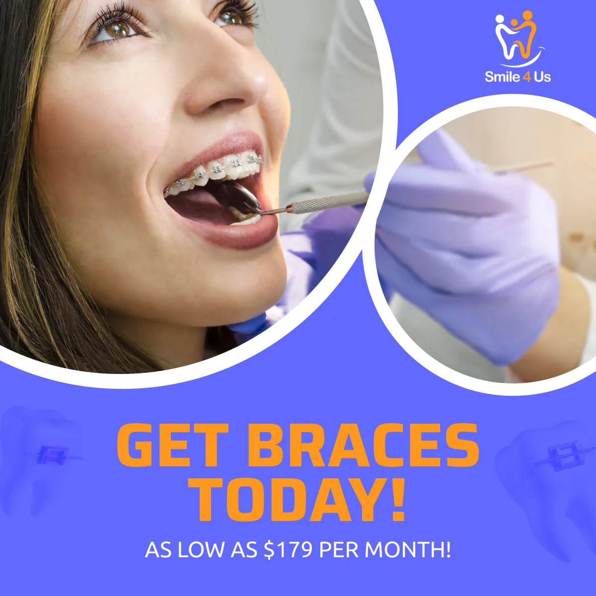 Braces promo banner